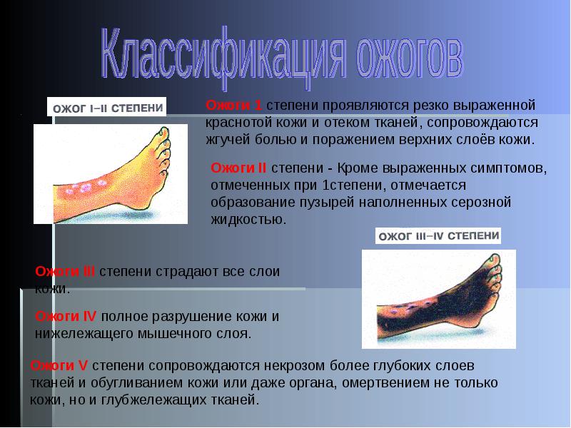 Какие виды ожогов не выявлены