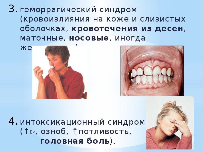 геморрагический синдром (кровоизлияния на коже и слизистых оболочках, кровотечения из десен,