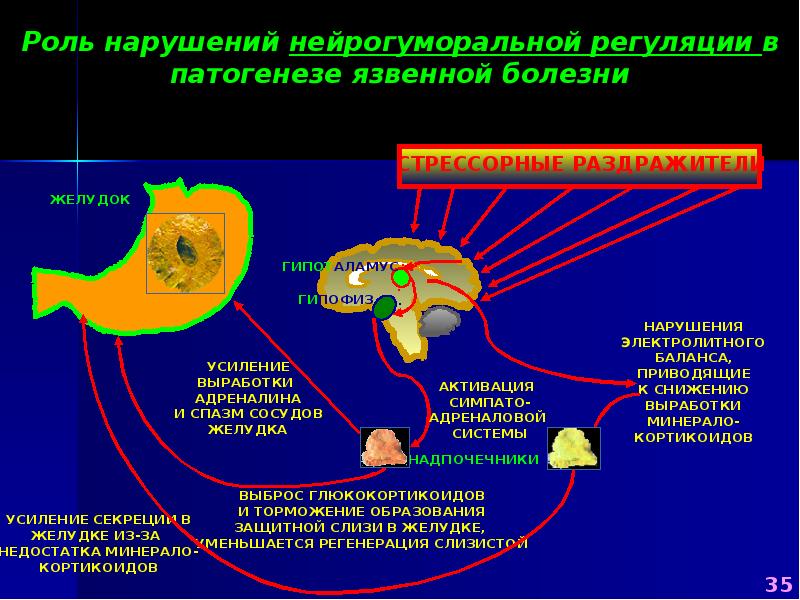 Патология выделительной системы презентация