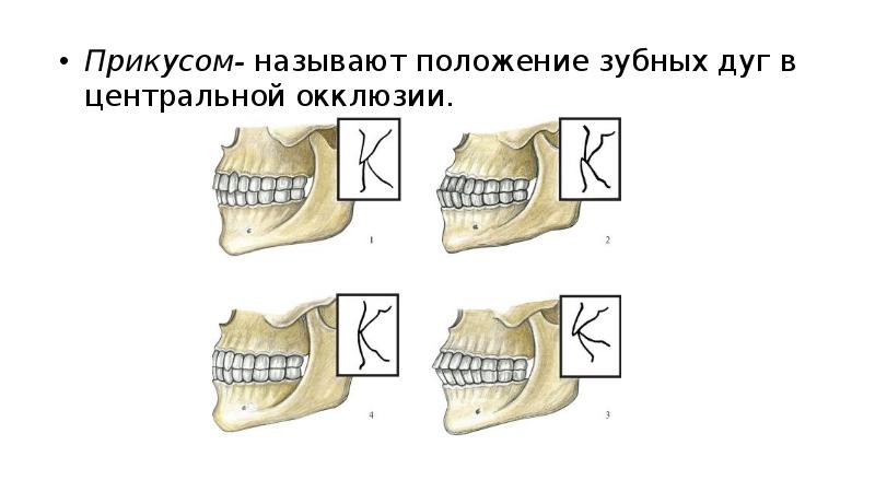 Виды прикусов презентация