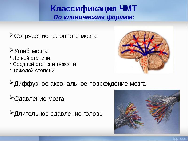 Черепно мозговая травма презентации