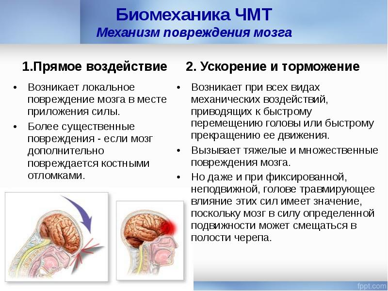 Тяжелые травмы головного мозга
