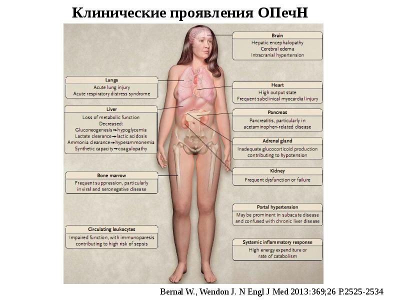 Презентация синдром острой токсической печеночной недостаточности