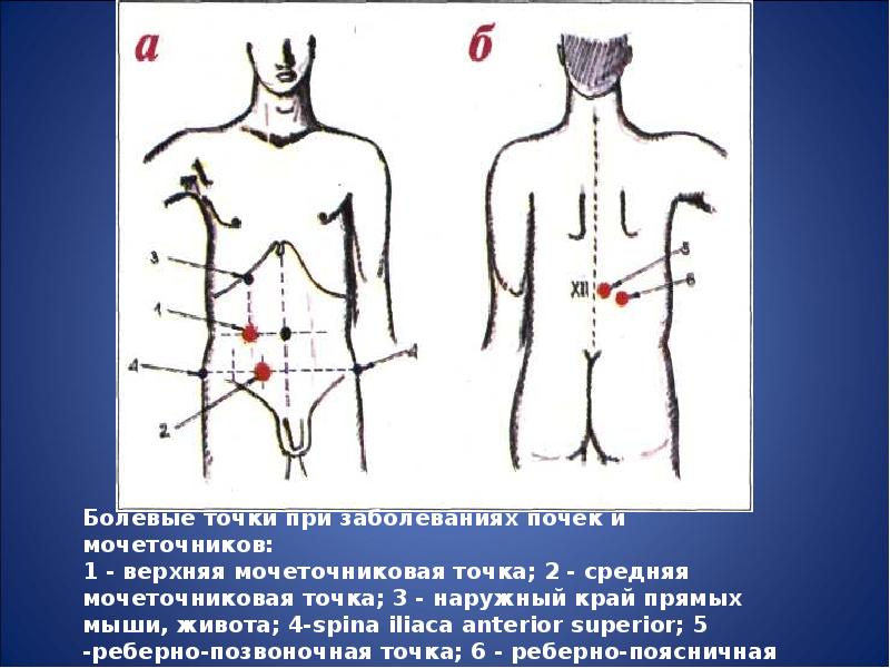 Точка полно. Болевые точки мочевыводящей системы. Болевые точки при мочеполовой системы. Мочеточниковые точки пропедевтика. Болевые точки при заболеваниях мочевыделительной системы.