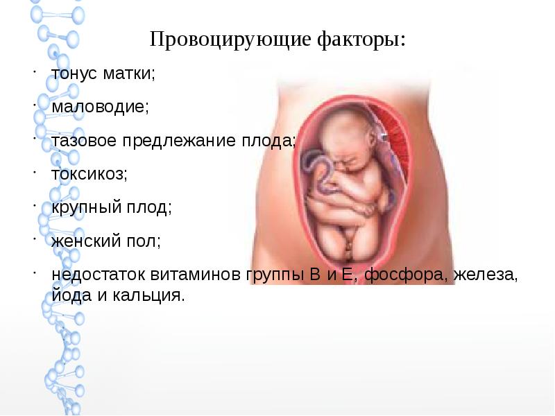 Скачать презентацию дисплазия тазобедренного сустава