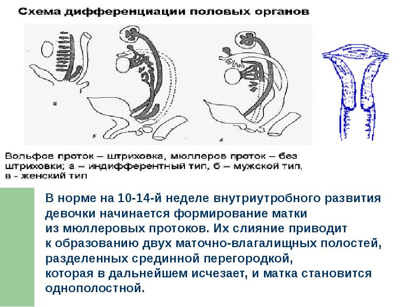 Аномалии женских половых органов презентация