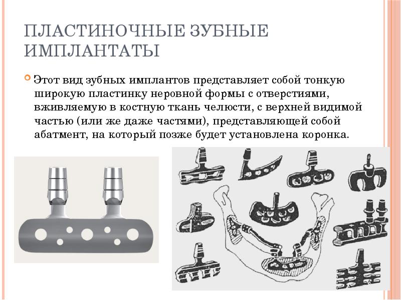 Пластиночные зубные имплантаты
Этот вид зубных имплантов представляет собой тонкую широкую Пластиночные зубные имплантаты
Этот вид зубных имплантов представляет собой тонкую широкую