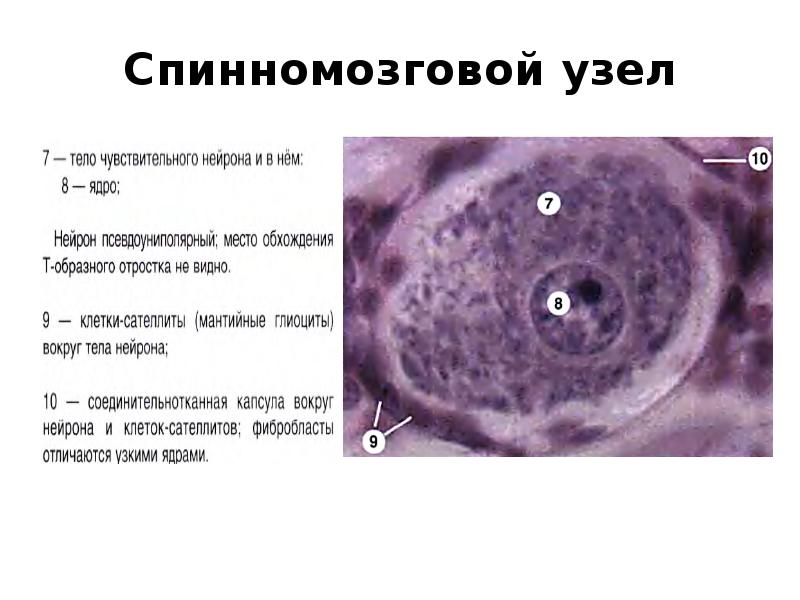 Спинномозговой узел Спинномозговой узел