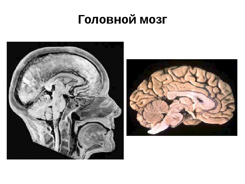 Головной мозг Головной мозг