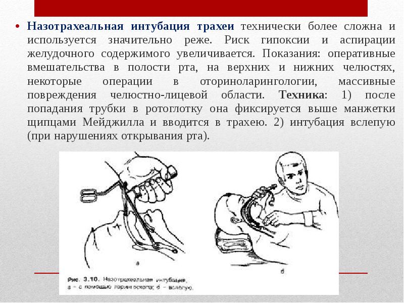 Для интубации трахеи больного укладывают на столе в положении