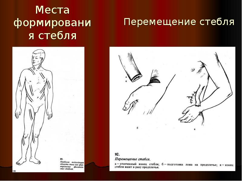 Пластическая хирургия презентация