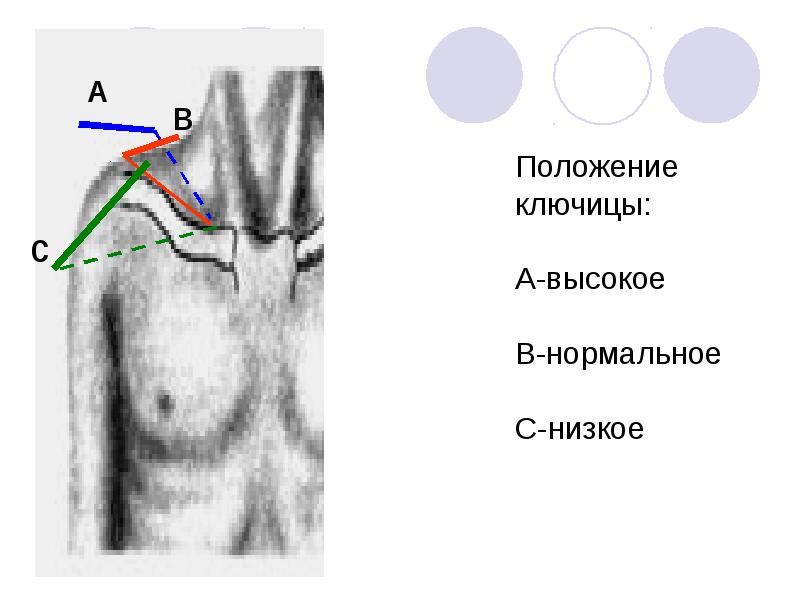Соединение ключицы с грудиной и лопаткой. Соединение ключицы с грудиной. Классификация ключично грудинного сустава. Ключица соединяется с. Соединение грудины с ключицей.
