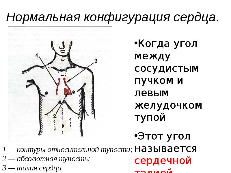 Перкуссия сердца. Конфигурации сердца пропедевтика. Поперечник сердца перкуссия. Длинник и поперечник сердца. Поперечник и длинник сердца в норме.