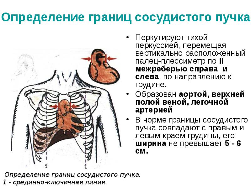 Перкуссия сердца. Ширина сосудистого пучка во 2-м межреберье составляет. Границы сердечно сосудистого контура в норме. Измерение ширины сосудистого пучка. Границы сосудистого пучка.