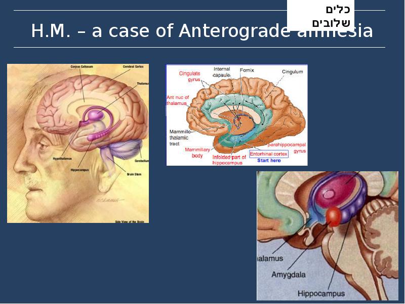 H.M. – a case of Anterograde amnesia H.M. – a case of Anterograde amnesia