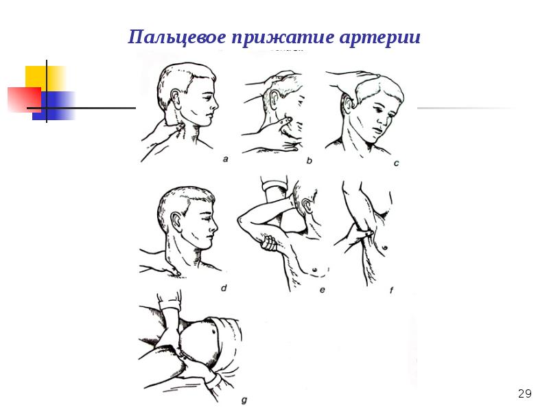 Презентация по кровотечению и гемостазу