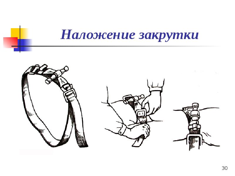 Презентация по кровотечению и гемостазу