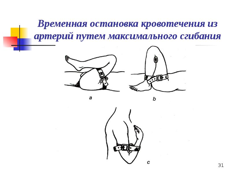 Презентация по кровотечению и гемостазу