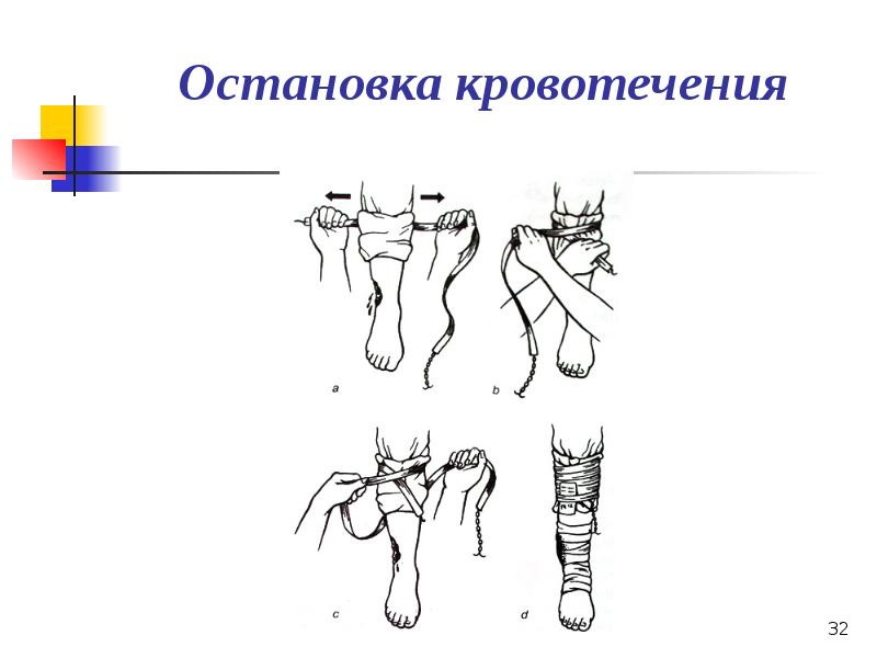 Презентация по кровотечению и гемостазу