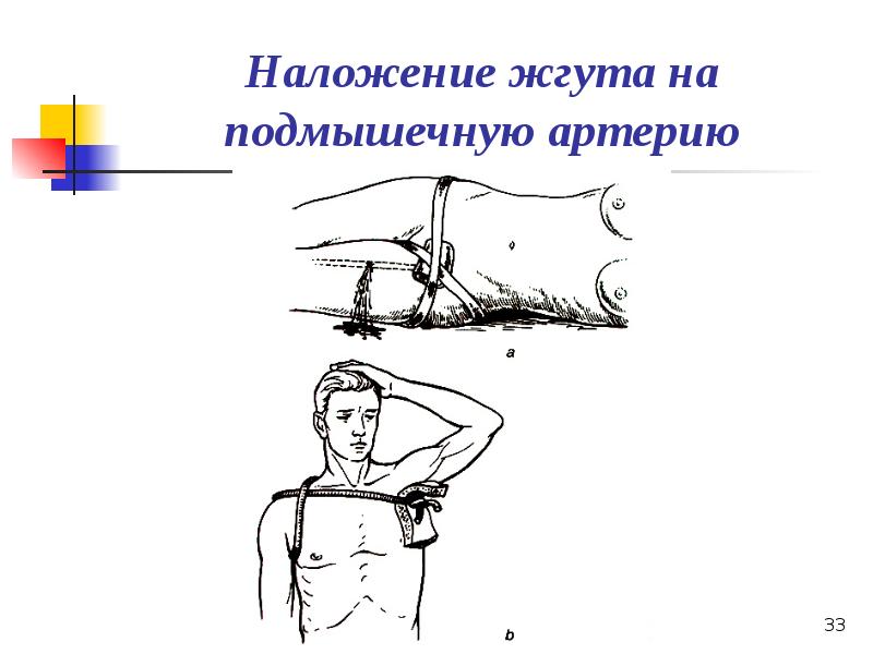 Презентация по кровотечению и гемостазу