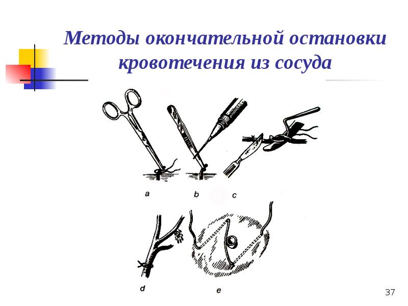 Презентация по кровотечению и гемостазу