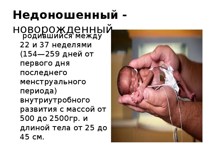 Сколько недель считается доношенная. Рождение недоношенных детей. Роды недоношенного ребенка. Недоношенный ребёнок сроки.