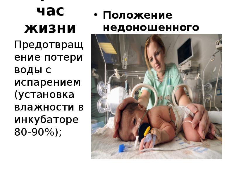 Недоношенные дети картинки