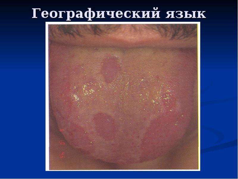 Географический язык