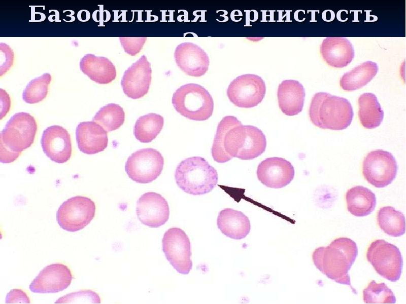 Базофильная зернистость Эр.