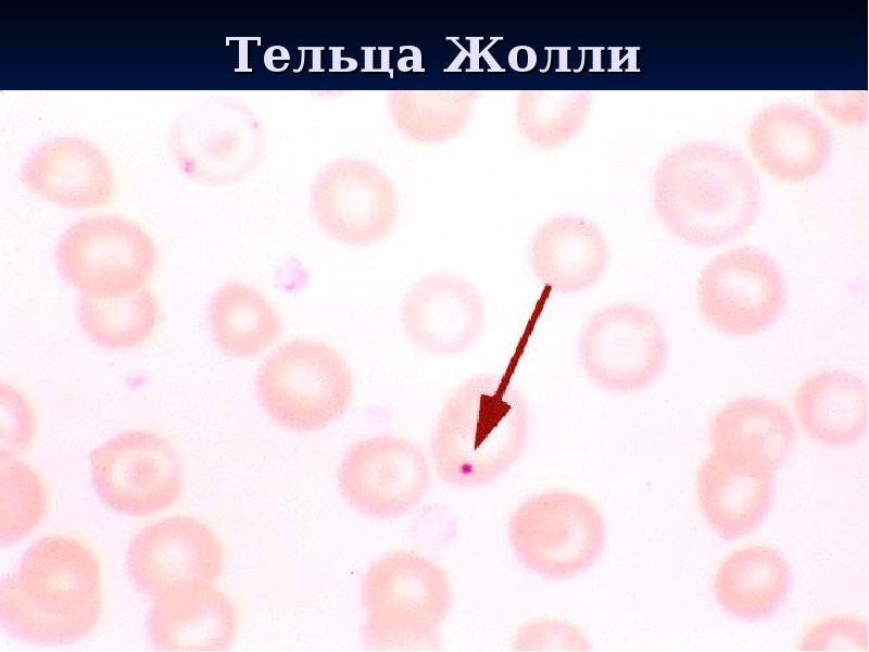 Тельца Жолли