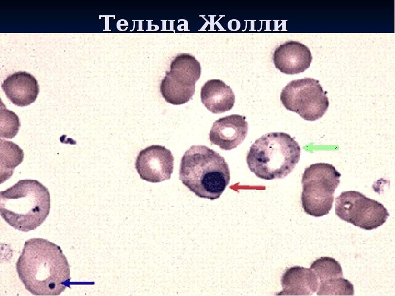 Тельца Жолли