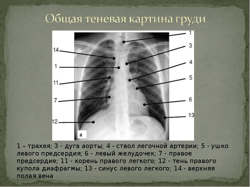 Картинка поражение легких