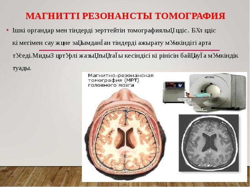 Субарахноидальды қан құйылу презентация