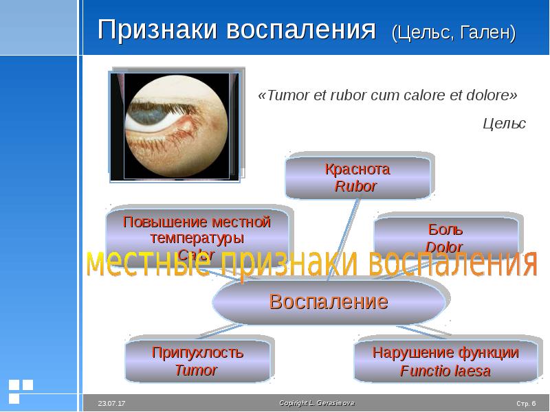 Презентация воспаление патологическая физиология