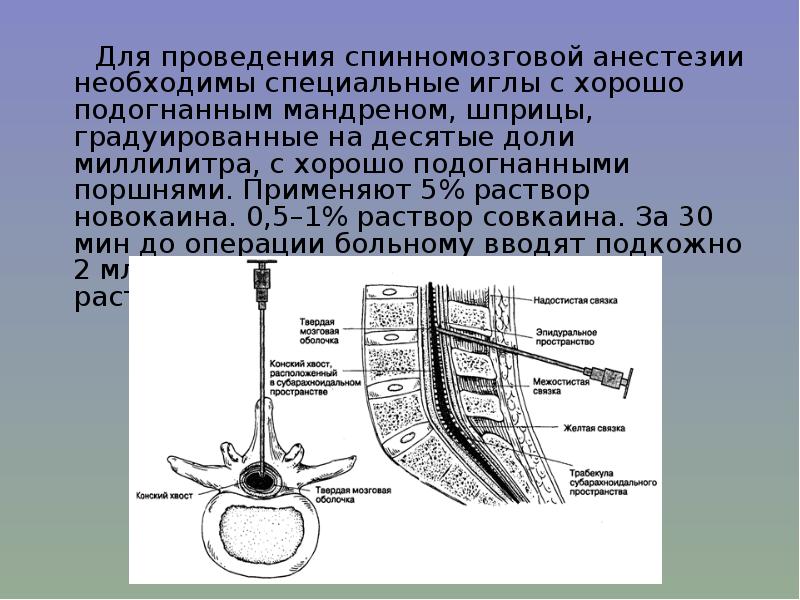 Спинномозговая анестезия презентация