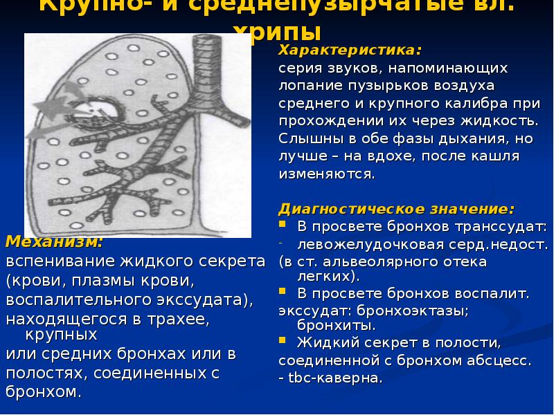 Полости в бронхах. Крупно и среднепузырчатые хрипы. Крупнопузырчатые хрипы. Среднепузырчатые хрипы. Крупнопузырчатые хрипы в легких заболевание.