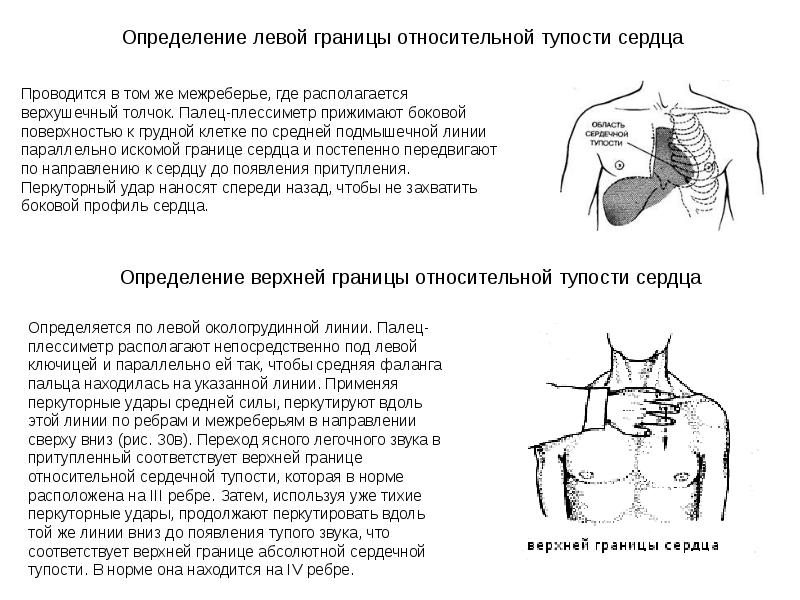 Определение границ сердечной тупости. Методика определения границ относительной сердечной тупости. Определение относительной сердечной тупости сердца. Определение левой границы относительной сердечной тупости. Определение правой границы относительной сердечной тупости.