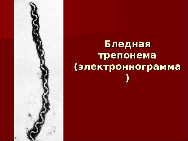 Бледная трепонема это. Бледная трепонема презентация. Движения бледной трепонемы. Бледная трепонема жизненный цикл. Диагностика бледной трепонемы.