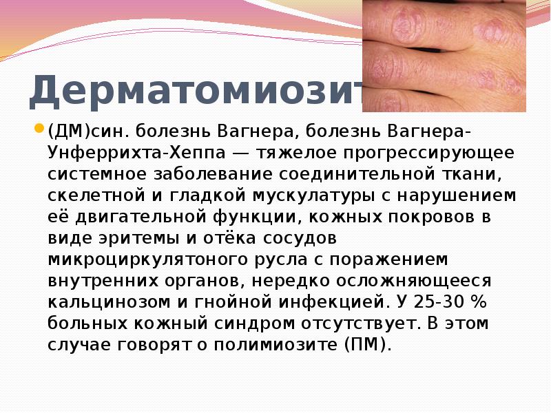 Плохие волосы кожа и ногти что пить