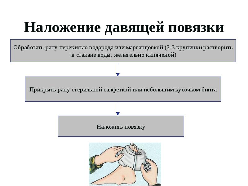 Наложить на рану. Наложение давящей повязки. Наложение давящей повязки на рану. Как накладывается давящая повязка. Показания для наложения давящей повязки.