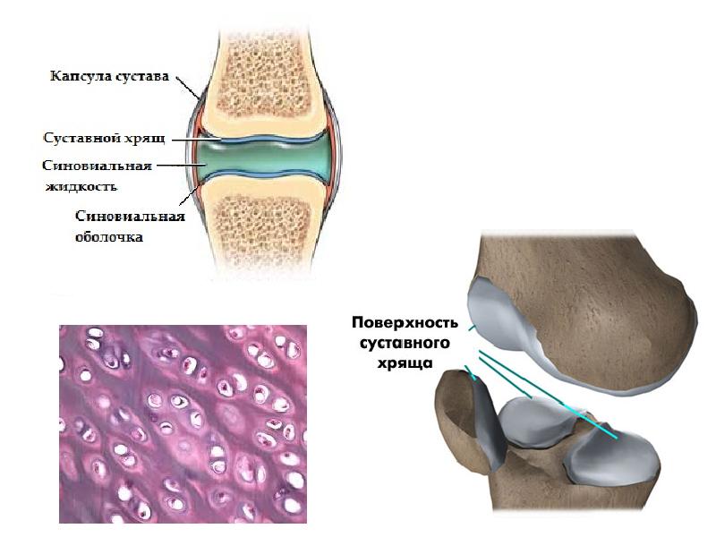Хрящевые суставы. Строение сустава гиалиновый хрящ. Сустав строение суставная жидкость. Синовиальная жидкость коленный сустав строение. Гиалиновый хрящ голеностопного сустава.