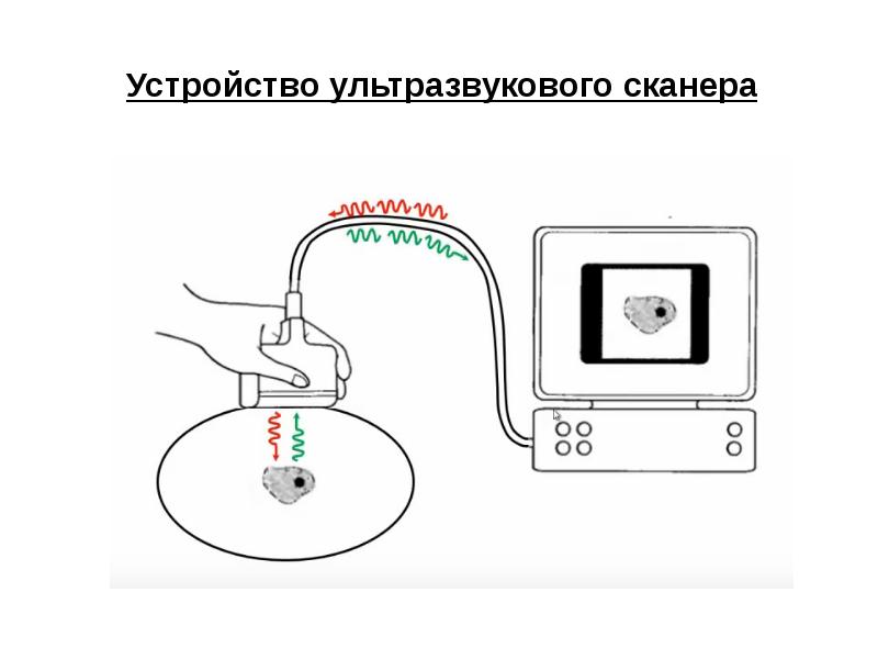 Структурная схема узи аппарата