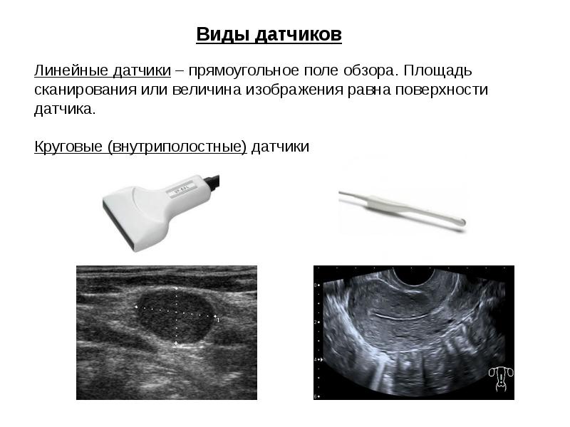 Изображение при узи получают