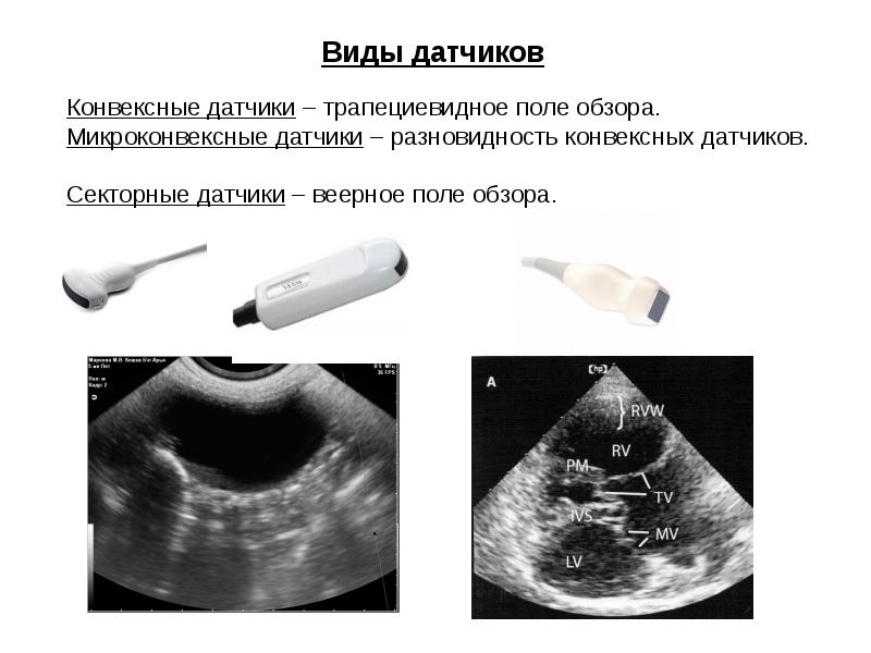 Изображение при узи получают