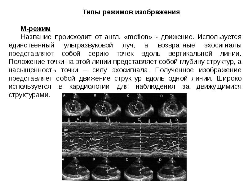 Принципы получения ультразвукового изображения сердца в трех режимах сканирования