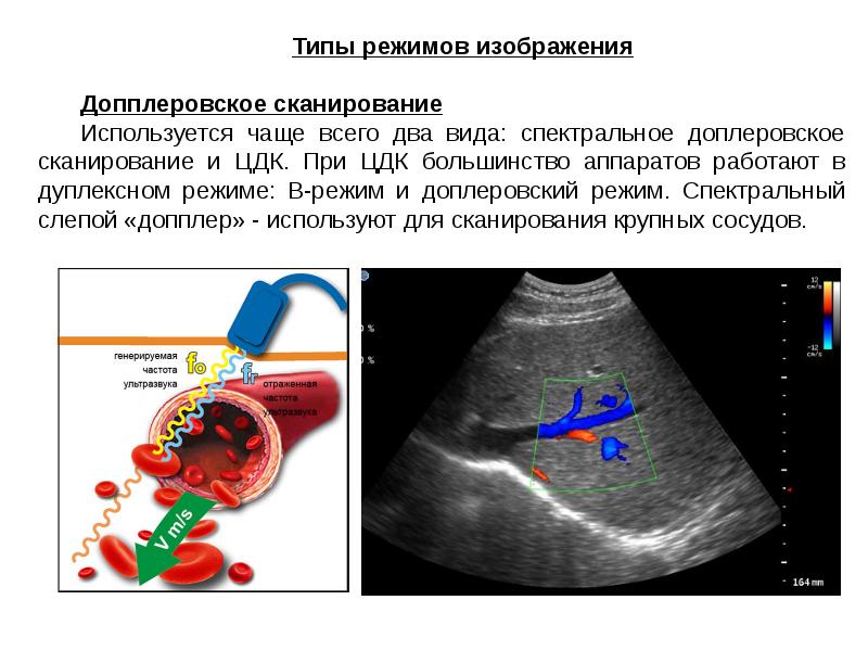 Ультразвуковое исследование презентация