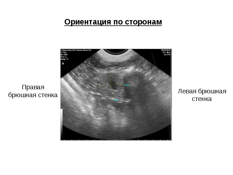 Презентация про узи