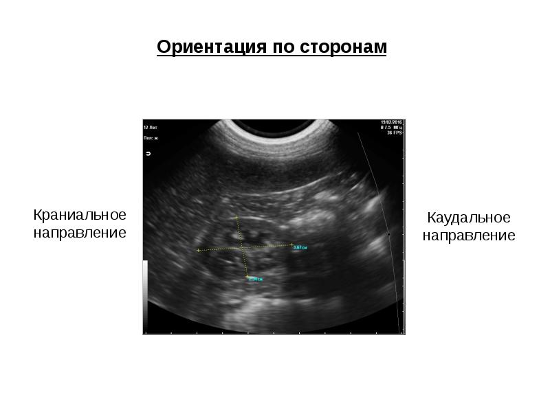 Ультразвуковое исследование презентация