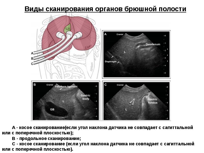 Проверить полость. Продольное и поперечное сканирование в УЗИ. Плоскости сканирования при УЗИ. УЗИ почки плоскость сканирования это. УЗИ фронтальная плоскость сканирования.