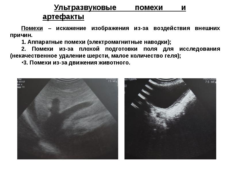 Ультразвуковое исследование презентация